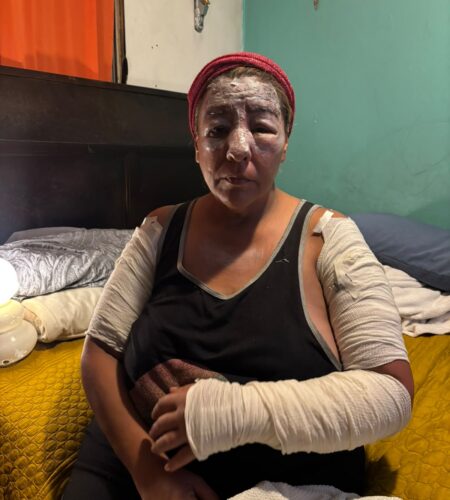 Rifa solidaria busca apoyar a Karime tras incendio que destruyó su hogar y dejó a su hija lesionada
